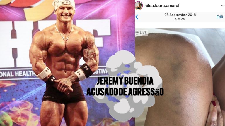 Hilda Amaral posta fotos das possíveis agressões sofridas por Jeremy Buendia