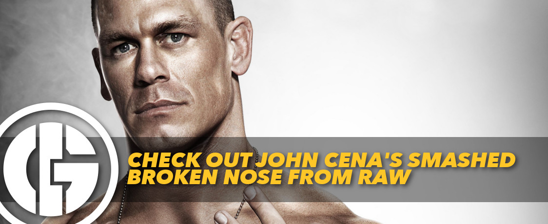 Generation Iron John Cena Broken nose