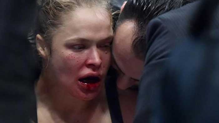 ronda-rousey-plastic-surgery2-worst faces
