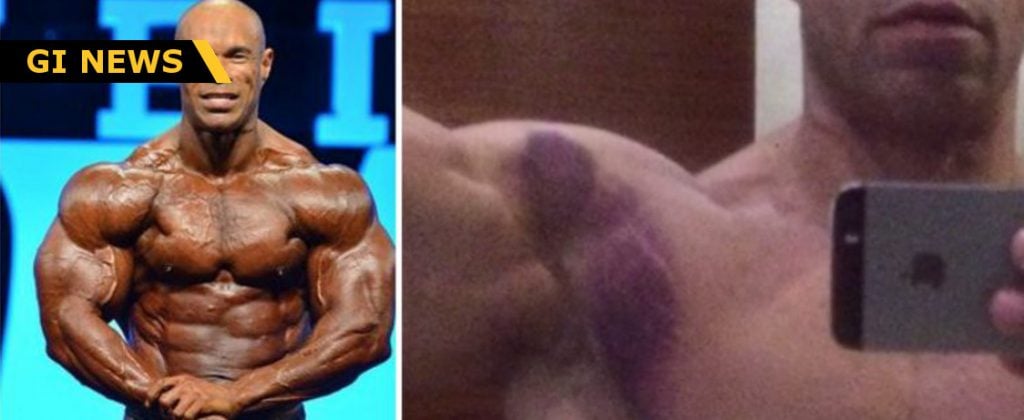Kevin Levrone Injury Before Olympia Generation Iron