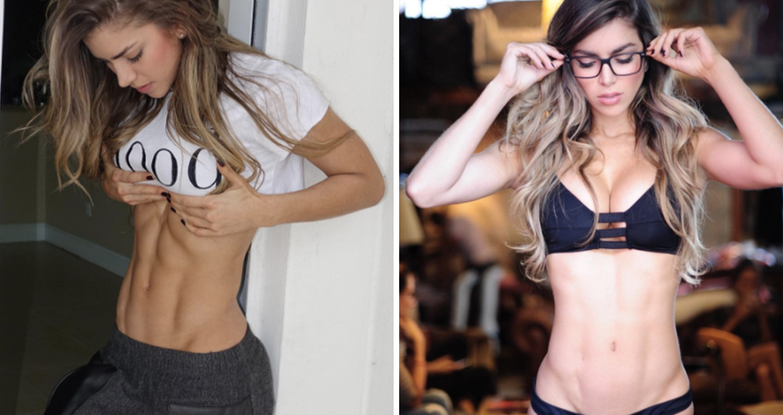 Anllela sagra before and after surgery
