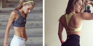 Bodybuilding Stops Anorexia Generation Iron