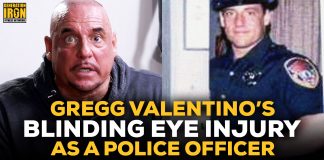 Gregg Valentino Eye Injury cop