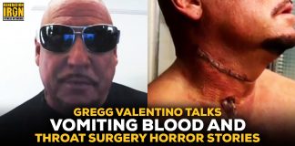 Gregg Valentino surgery
