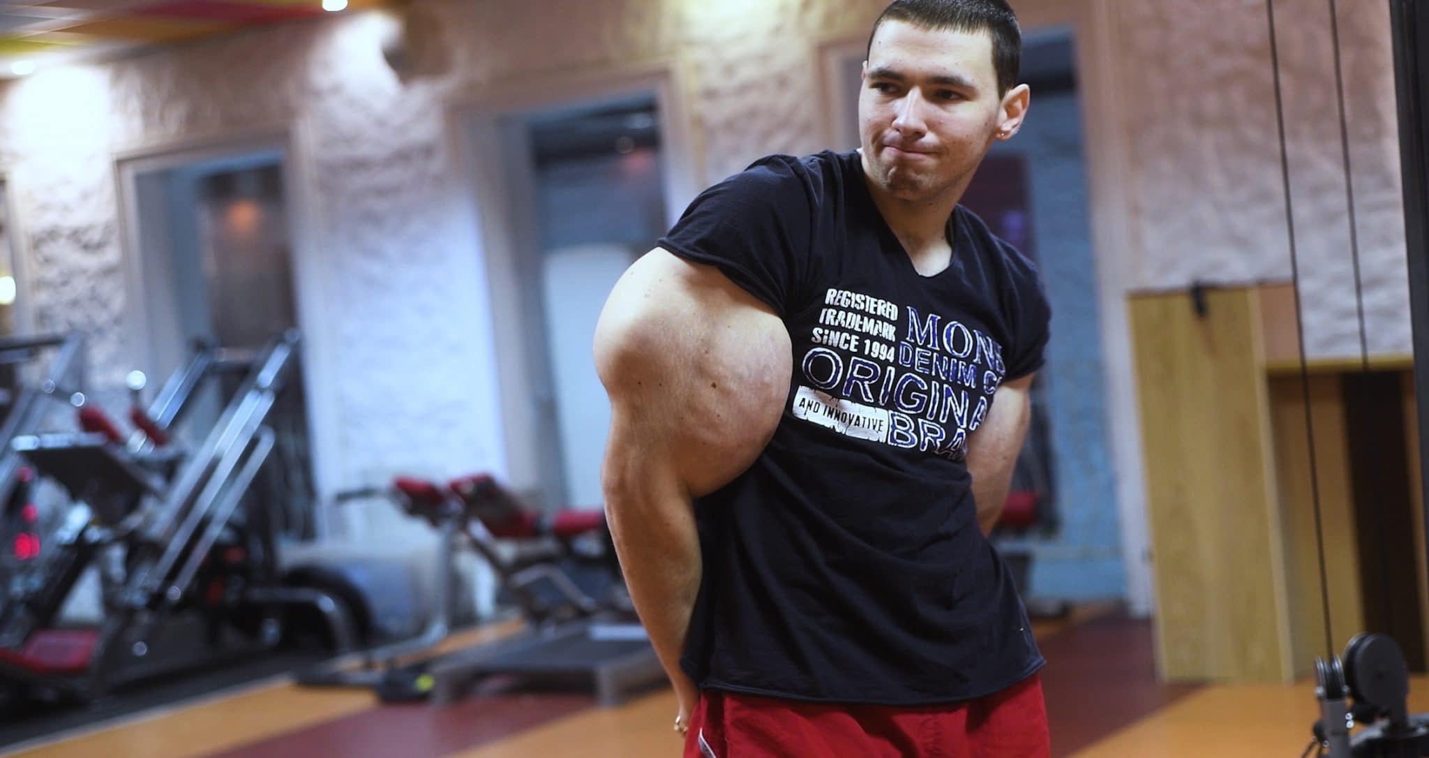 Kirill Tereshin Risks Death If Jelly Is Not Removed From Biceps