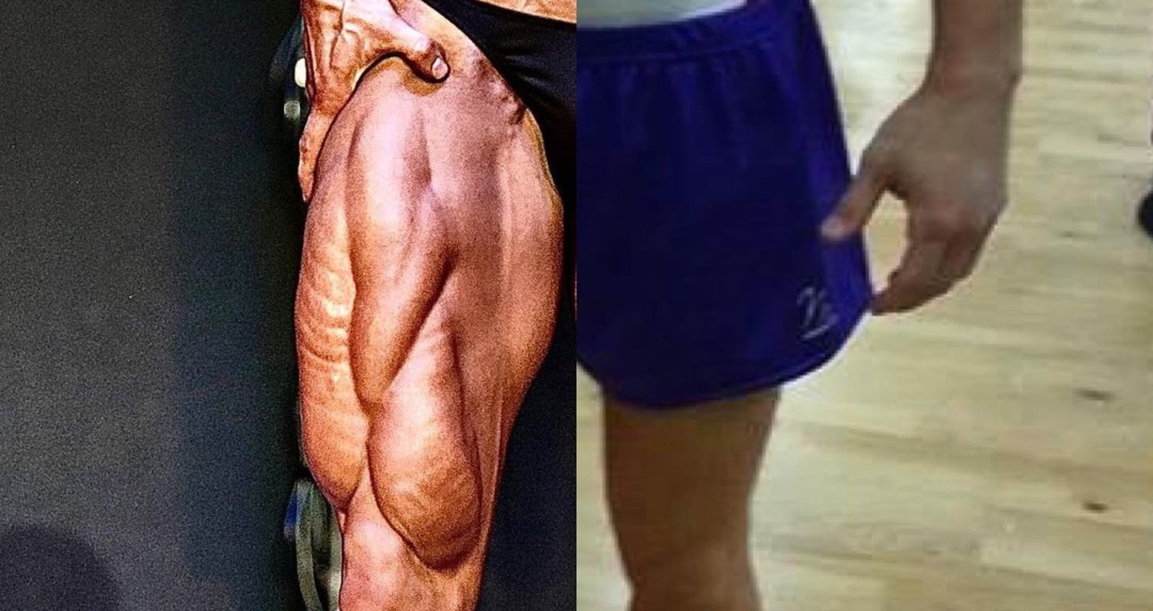 grens Jumping jack Zich afvragen PNBA Mitch Jarvis On Why You Shouldn't Blame Genetics for Skinny Legs -  Generation Iron Fitness & Strength Sports Network
