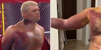 Wrestler Cody Rhodes Torn Pec