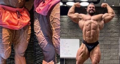 Leg Vascularity