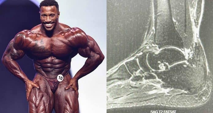 Patrick Moore bodybuilder achilles tendon injury