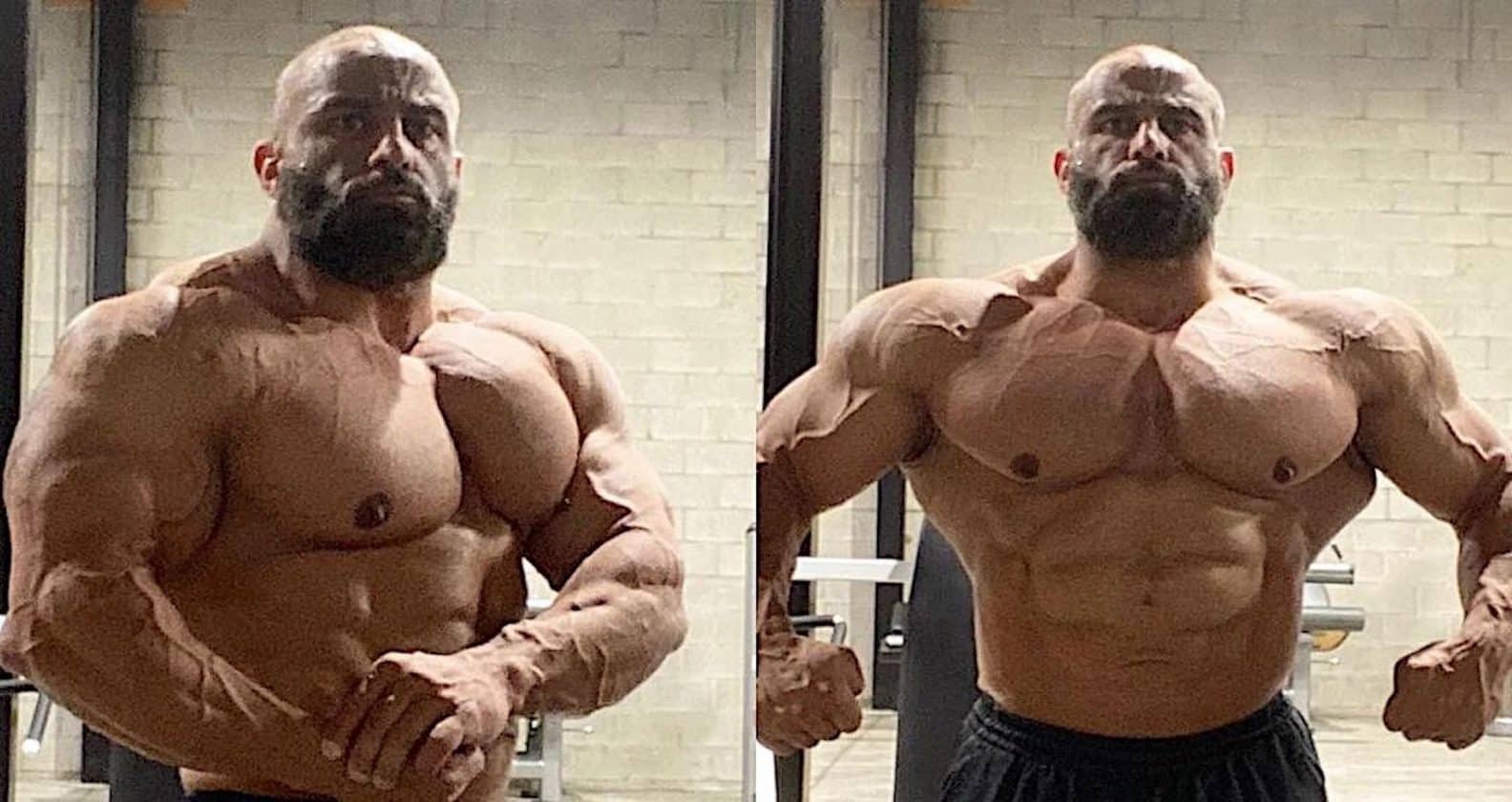 Fouad Abiad Gives Update On Kidney Damage That Forced His Retirement