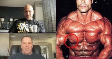 Gyno