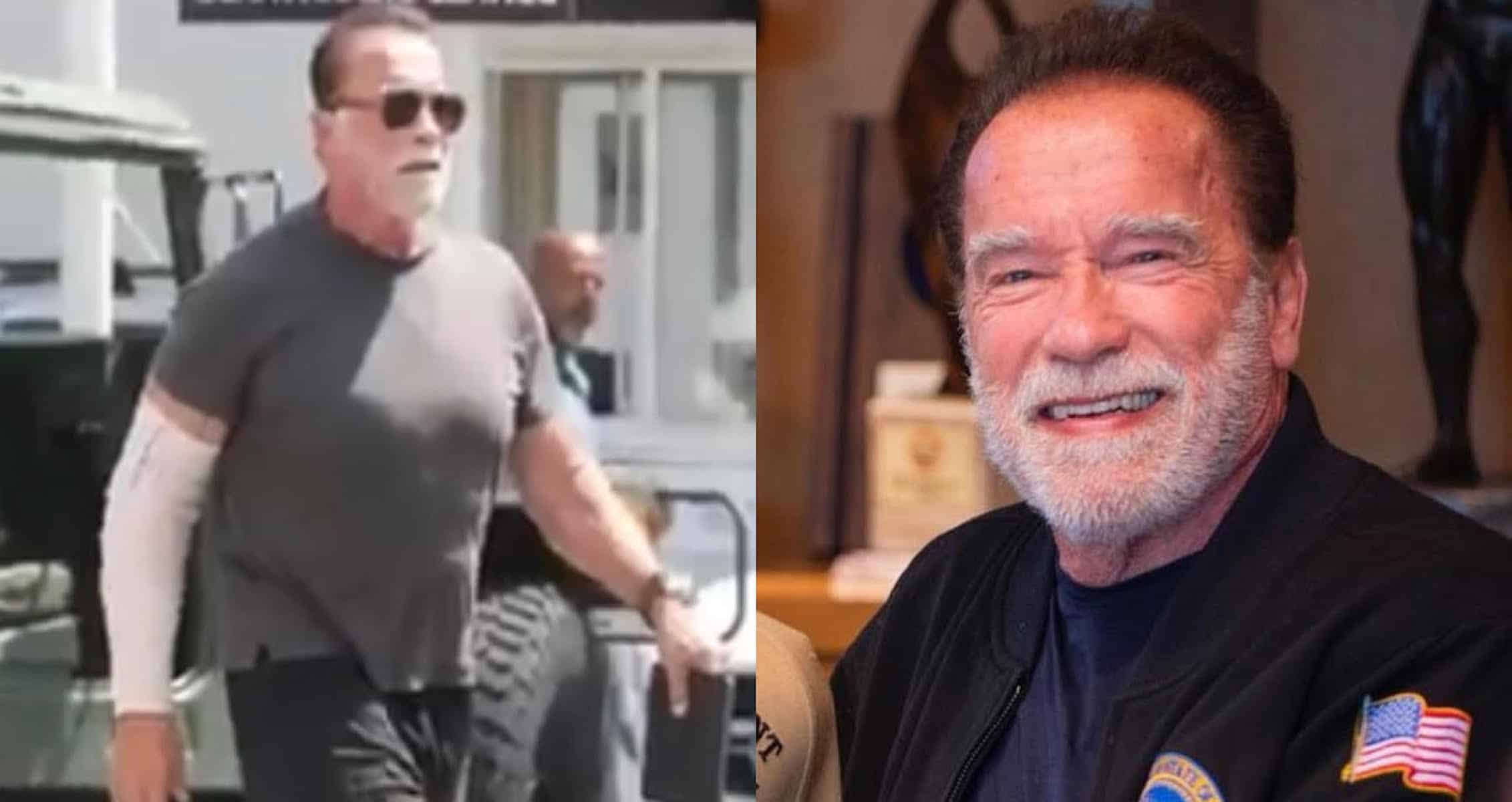 Arnold Schwarzenegger Seen With Elbow Wrapped Following Nerve Damage ...