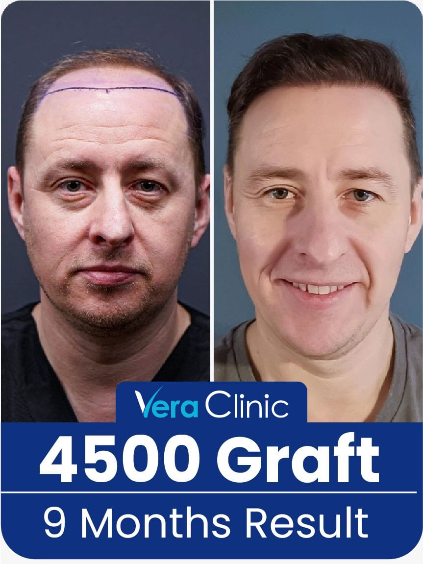 Vera Clinic Before and After