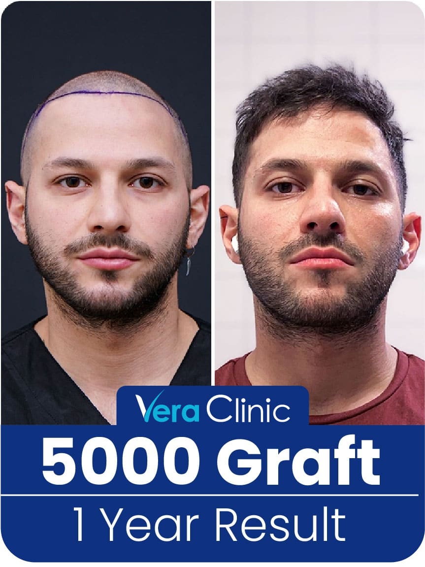 Vera Clinic before and after