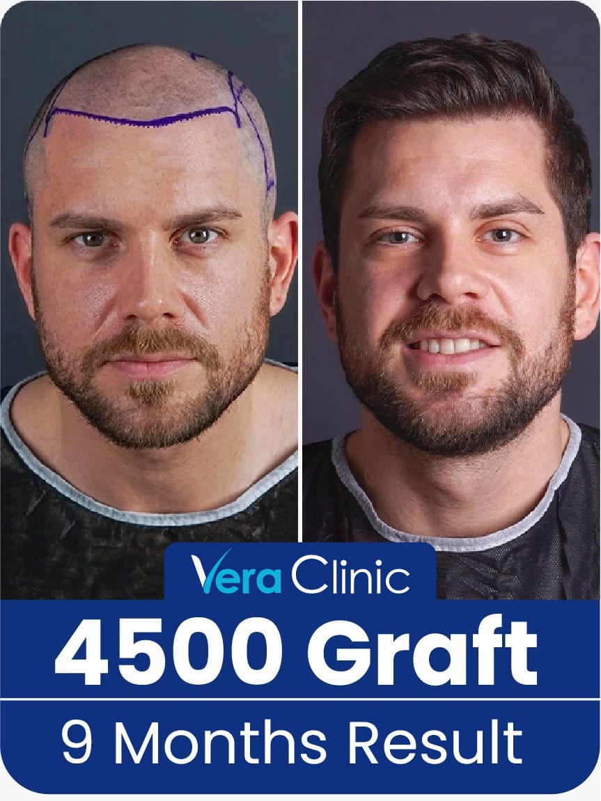 Vera Clinic before and after