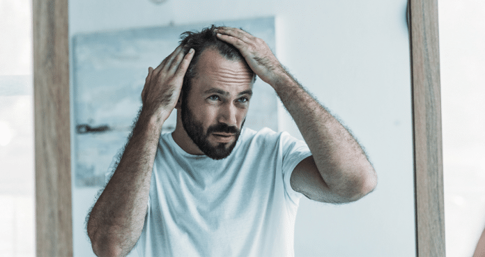 stress and hair loss