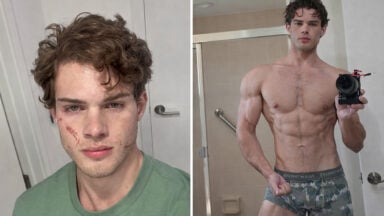 Looksmaxxing Influencer Clavicular Hospitalized After Suspected Overdose During Livestream
