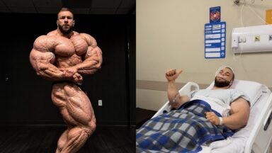 Good Vito Undergoes Surgery to Improve Breathing After 10-Year Nasal Spray Dependency