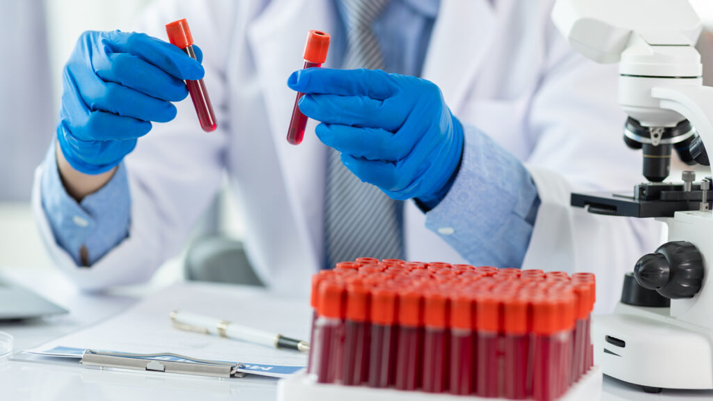 blood test